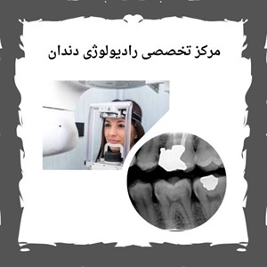 آشنایی با عملکرد بهترین مرکز رادیولوژی دندان سعادت آباد