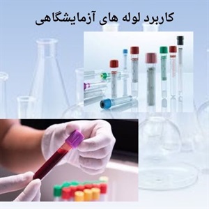 راهنمای انتخاب لوله آزمایشگاهی مناسب