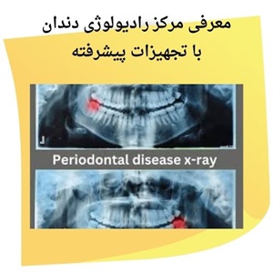بهترین مرکز رادیولوژی دندان سعادت آباد